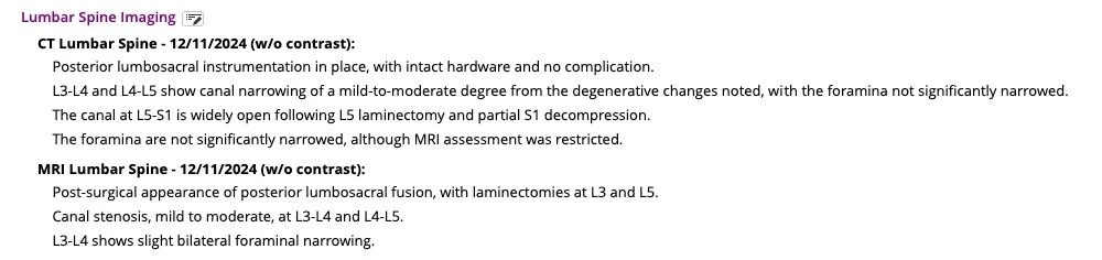 The Lumbar Spine Imaging section of a real eCW note written by bellwiQ: the two newest studies, a CT and an MRI, each with findings listed level by level.